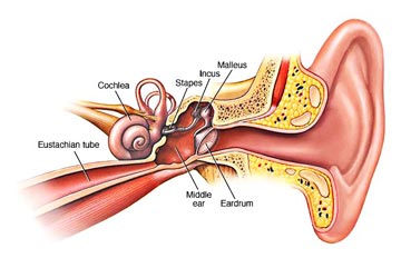Eardrum Perforation
